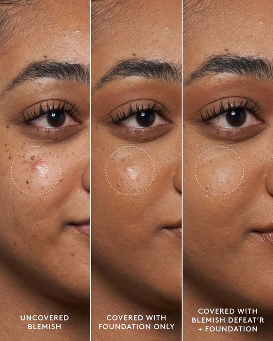 Blemish Defeat'r BHA Spot-Targeting Gel