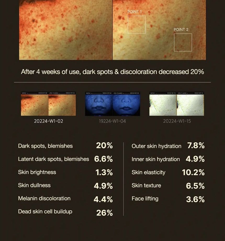 Medicube Deep Vita C Ampoule Set [10g x 3 pcs] | For Dark Spots