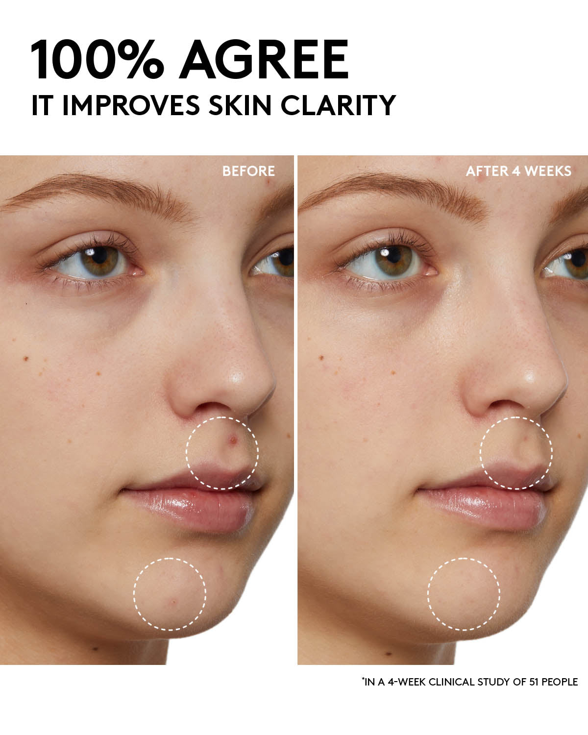 Fenty Skin Start’rs Full-Size Bundle with Mineral SPF: Oily Skin Edition