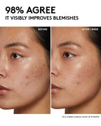 Cherry Dub Pore Purify'r Gel Cleanser with Niacinamide + Aloe Juice