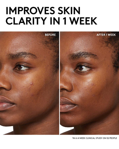 Fenty Skin Start’rs Full-Size Bundle with Mineral SPF: Oily Skin Edition
