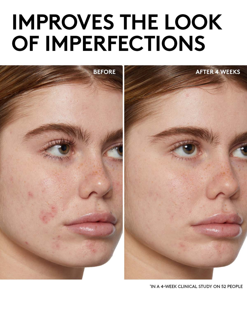 Fenty Skin Start’rs Full-Size Bundle with Mineral SPF: Oily Skin Edition