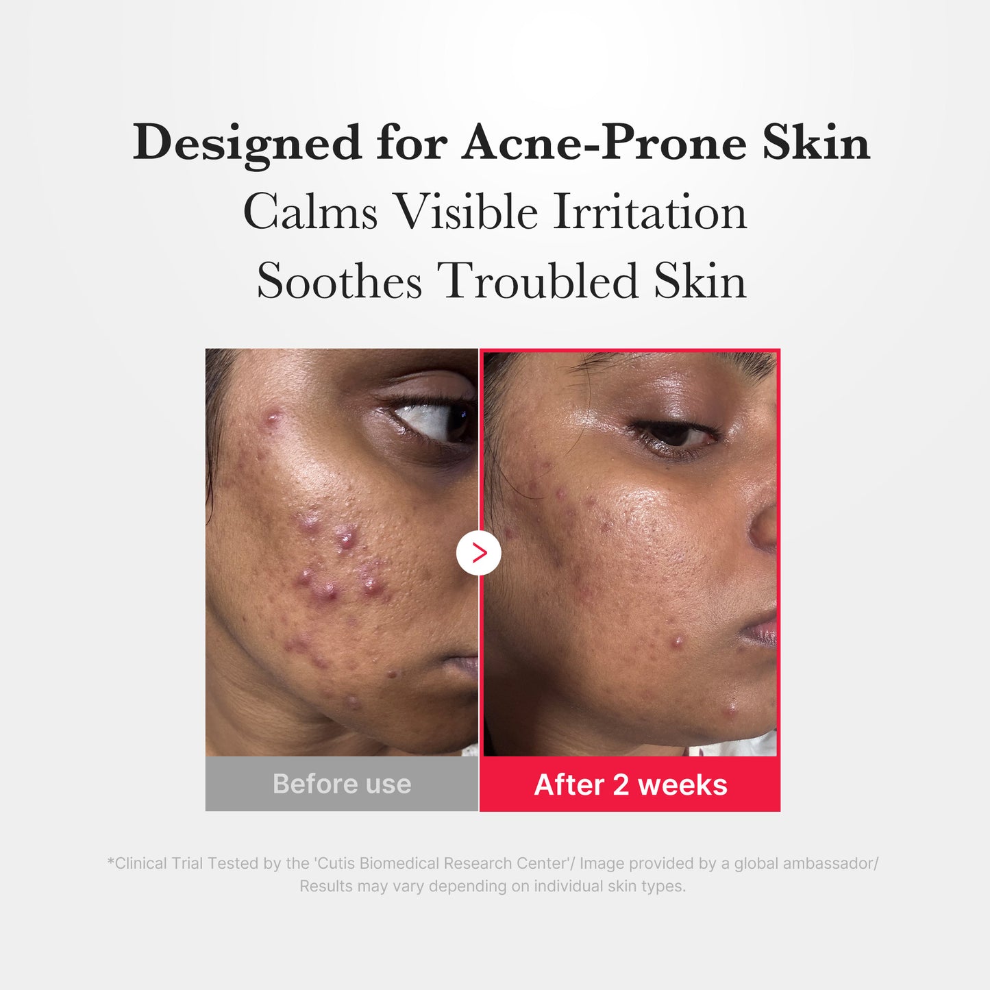 Medicube Hypochlorous Acid Daily Facial Spray 125ml | Acne & Redness Care