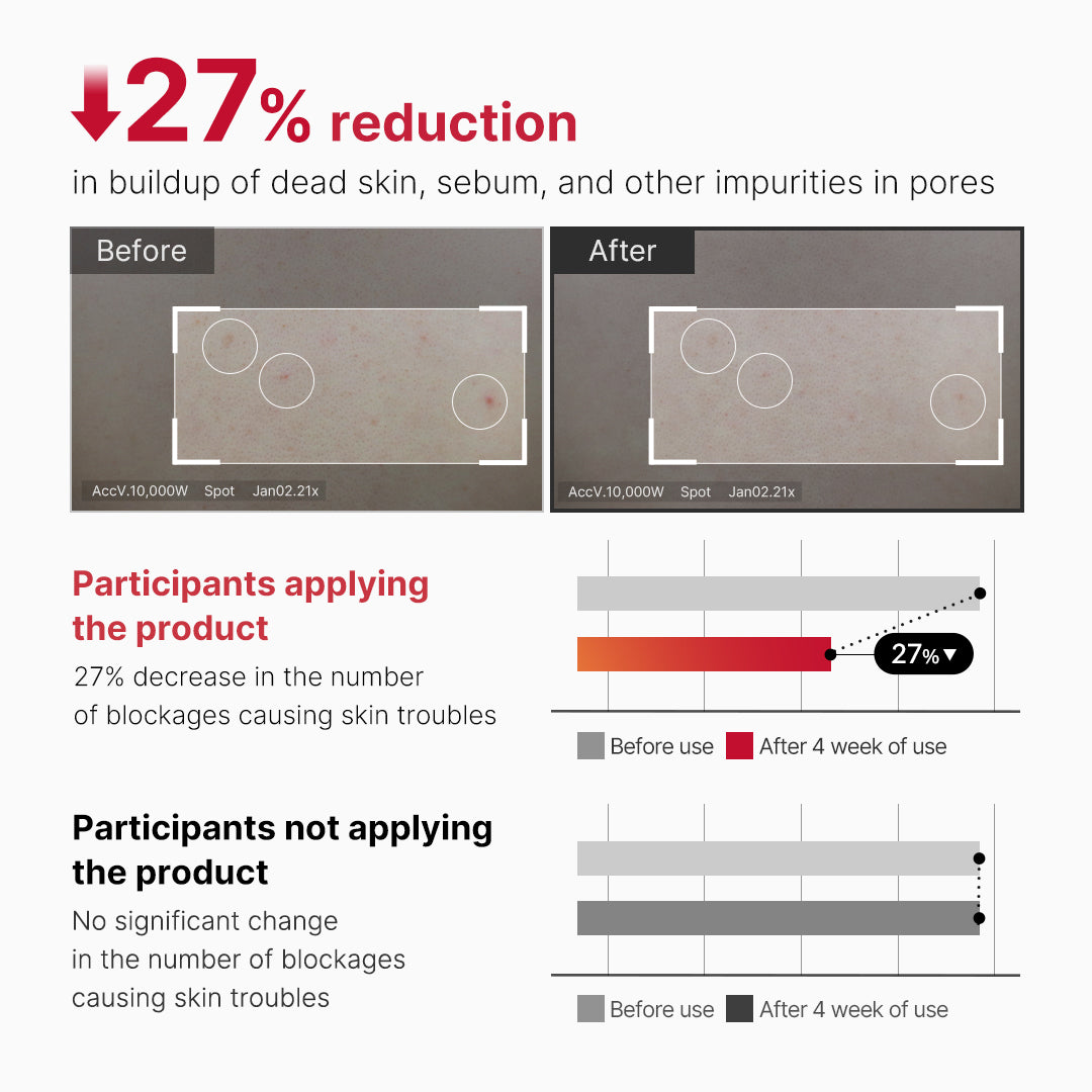 Medicube Red Acne Body Peeling Shot 2.0 110gm | Exfoliating Spray