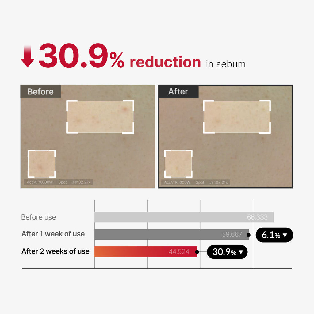 Medicube Red Acne Body Peeling Shot 2.0 110gm | Exfoliating Spray