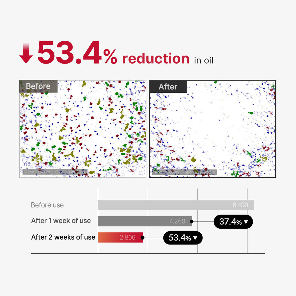 Medicube Red Acne Body Peeling Shot 2.0 110gm | Exfoliating Spray