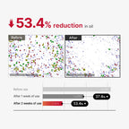 Medicube Red Acne Body Peeling Shot 2.0 110gm | Exfoliating Spray