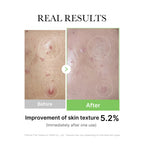 Medicube Exosome CICA Ampoule 30ml | Soothing & Hydrating Care