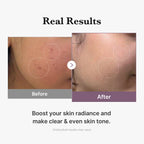 Medicube Age-R Glutathione Glow Toner 140ml | Brightening Milky Toner