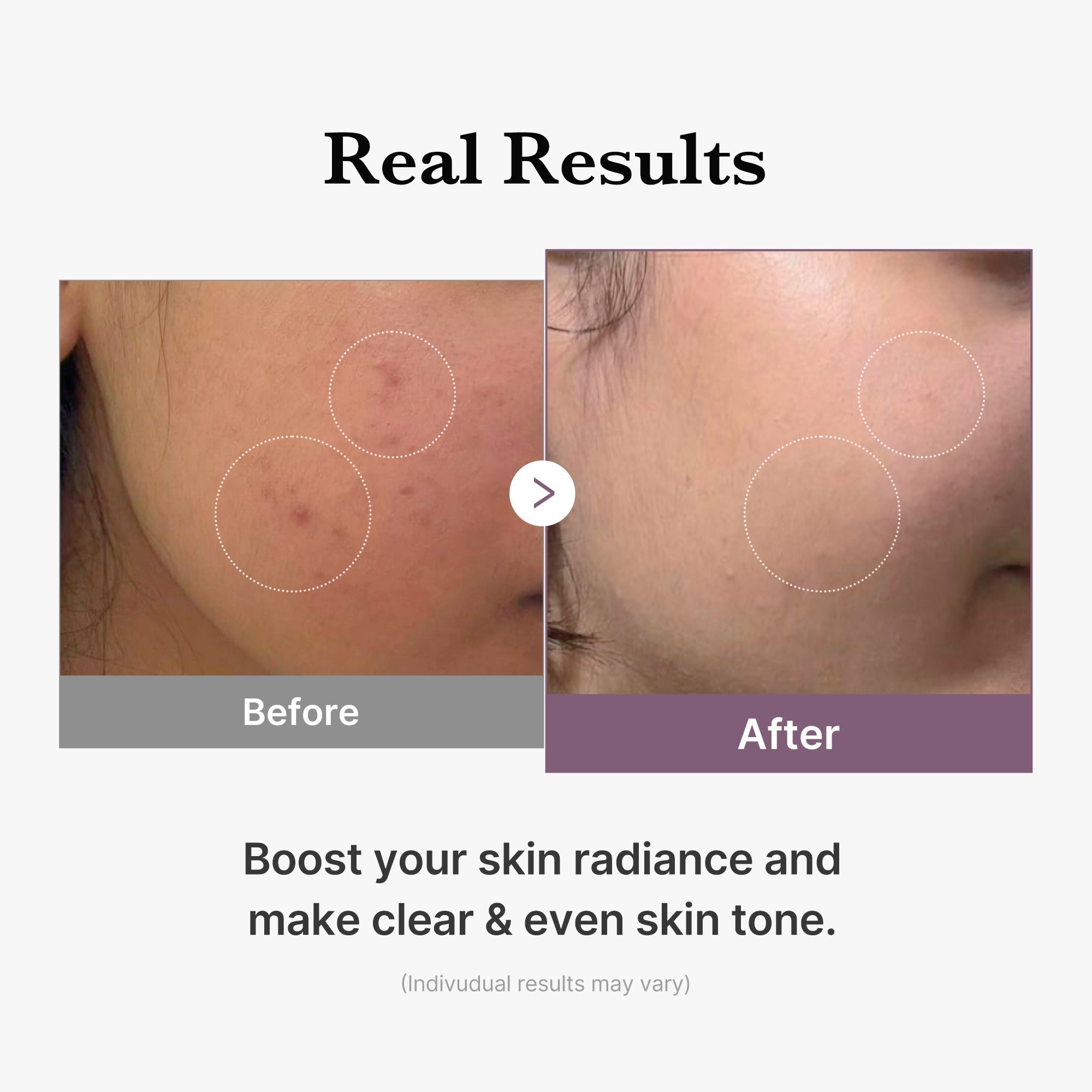 Medicube Age-R Glutathione Glow Toner 140ml | Brightening Milky Toner