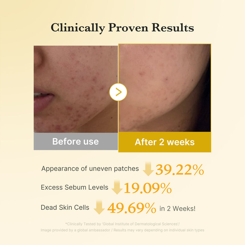 Medicube Kojic Acid Turmeric Pads  70pcs | Dark Spot & Texture Care