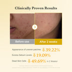 Medicube Kojic Acid Turmeric Pads  70pcs | Dark Spot & Texture Care