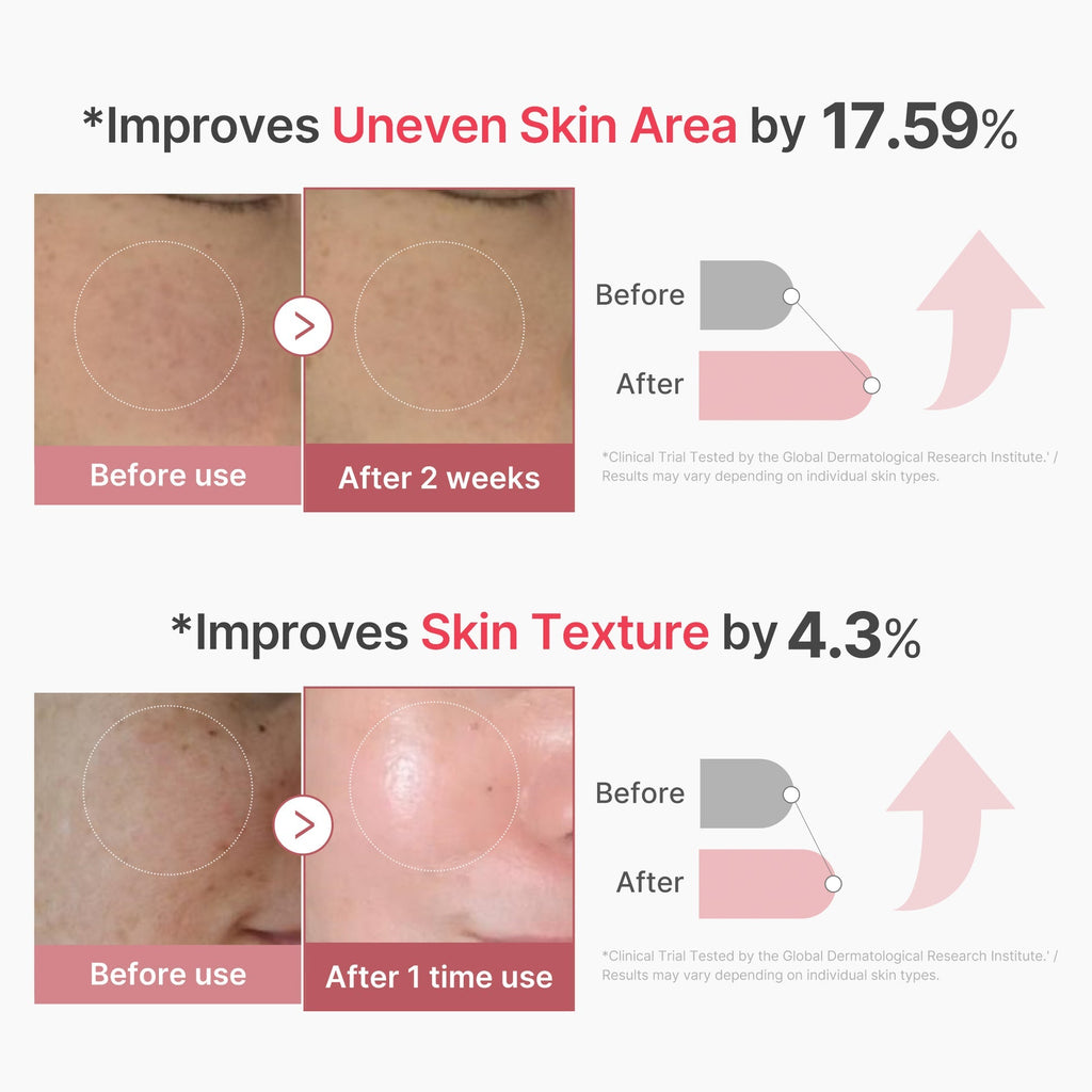 Medicube PDRN Pink Exosome Shot Serum 7500 30ml | High-End Pore Care