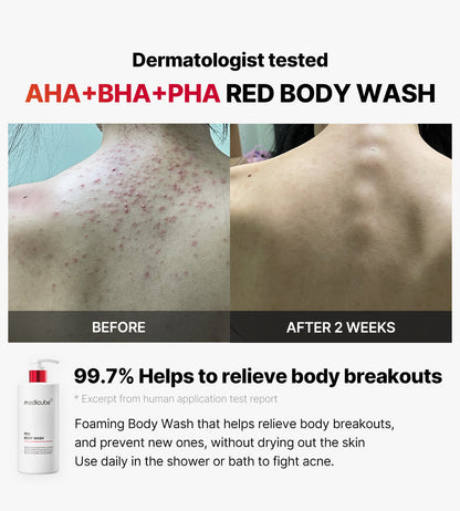 Medicube Red Acne Body Wash 2.0 400g