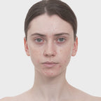 Medicube Red Succinic Acid Clarifying Serum 30ml | Acne & Spot Care