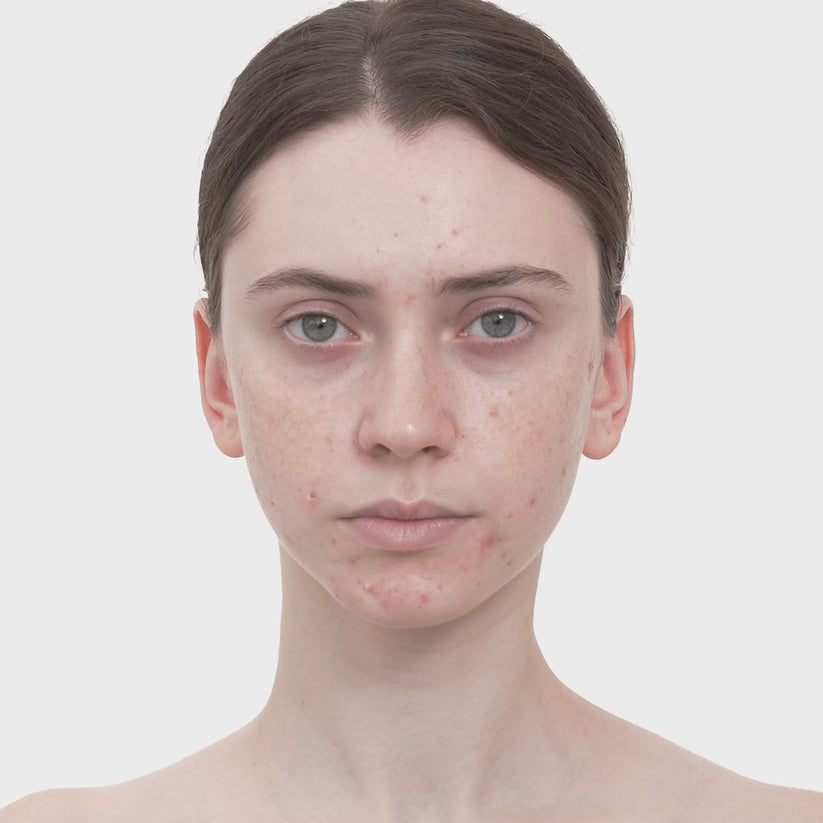 Medicube Red Succinic Acid Clarifying Serum 30ml | Acne & Spot Care