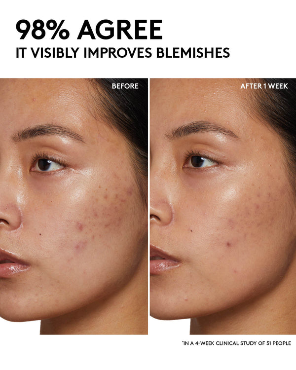 Cherry Dub Pore Purify'r Gel Cleanser with Niacinamide + Aloe Juice