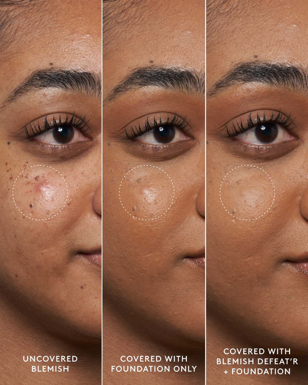 Blemish Defeat'r BHA Spot-Targeting Gel