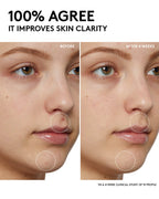 Cherry Dub Pore Purify'r Gel Cleanser with Niacinamide + Aloe Juice